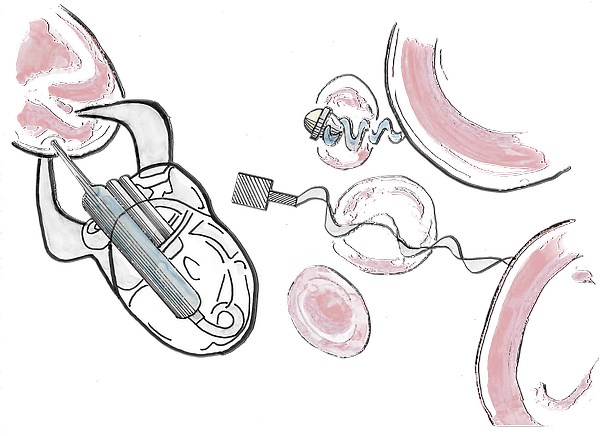 Zeichnungen von Nanaobots, die noch in der Entwicklung sind